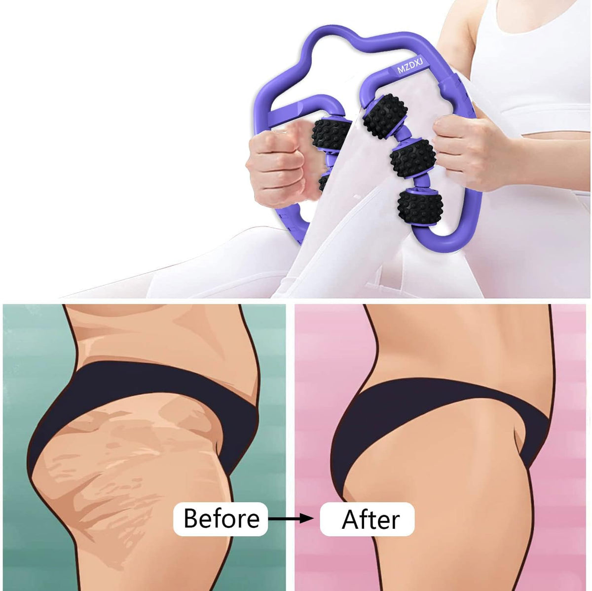 Cellulite Massage Tool Deep Fascia Massager & Dimpled Skin Remover for Legs - Anti-Cellulite Roller Tech with Lymphatic Drainage, Smooth Skin & Pain Relief for Thighs & Buttocks Sculpting