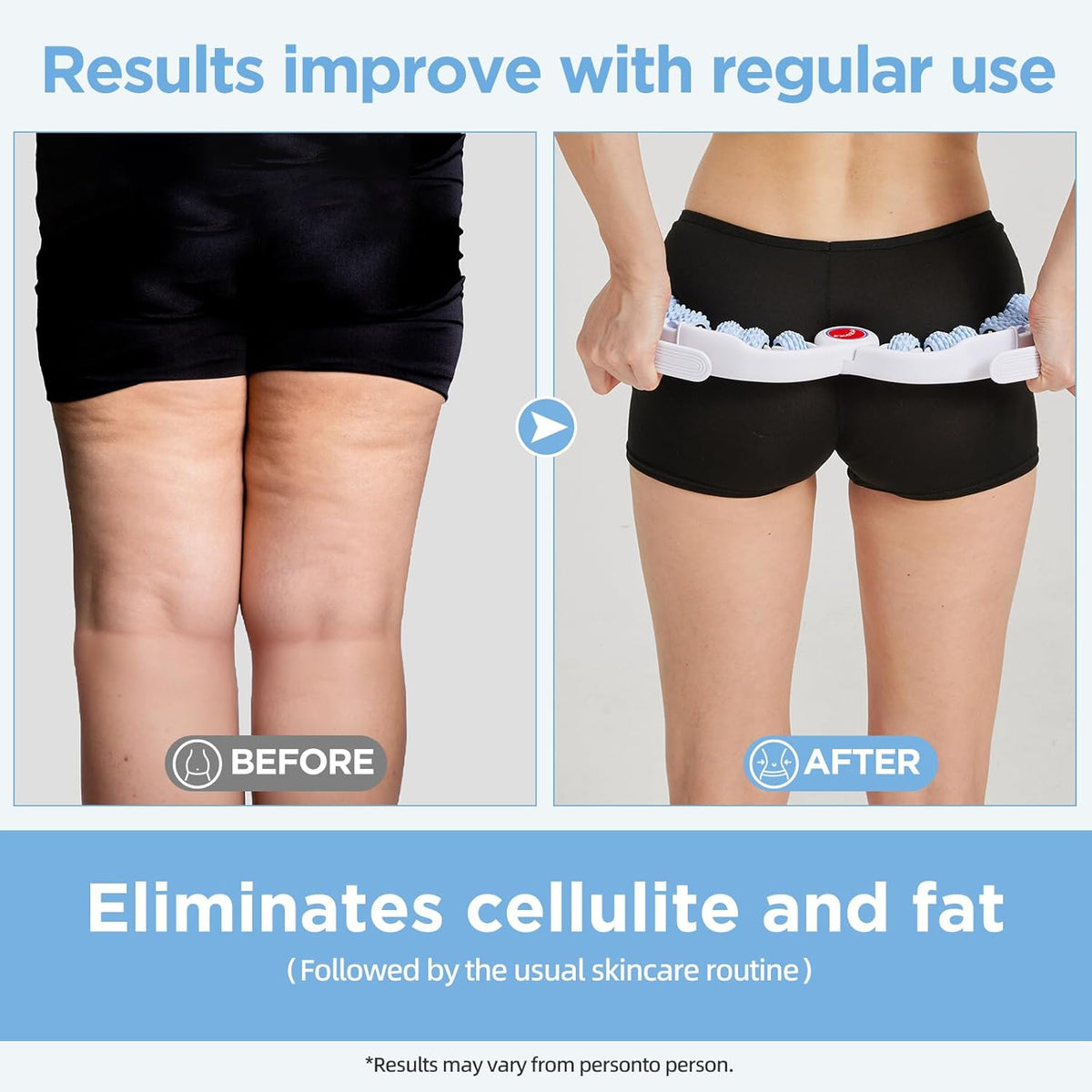 Cellulite Massage Tool Deep Fascia Massager & Dimpled Skin Remover for Legs - Anti-Cellulite Roller Tech with Lymphatic Drainage, Smooth Skin & Pain Relief for Thighs & Buttocks Sculpting